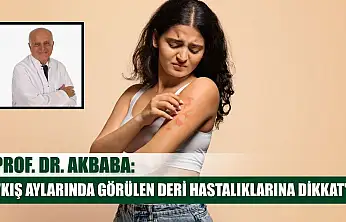 Prof. Dr. Akbaba: 'Kış aylarında görülen deri hastalıklarına dikkat'