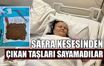 Safra kesesinden çıkan taşları sayamadılar