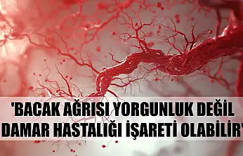 Uzmanı uyardı: 'Bacak ağrısı yorgunluk değil, damar hastalığı işareti olabilir'