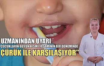 Uzmanından uyarı: 'Çocukların büyük kısmı yaşamının bir döneminde çürük ile karşılaşıyor'