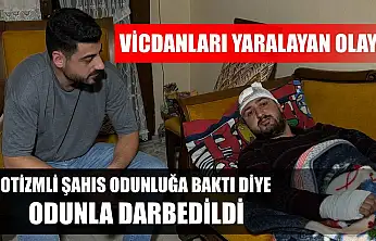 Vicdanları yaralayan olay: Otizmli şahıs odunluğa baktı diye odunla darbedildi