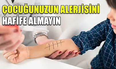 Çocuğunuzun alerjisini hafife almayın