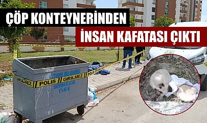 Çöp konteynerinden insan kafatası çıktı