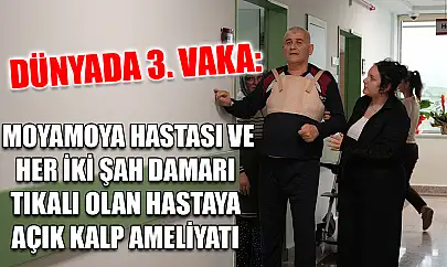 Dünyada 3. vaka: Moyamoya hastası ve her iki şah damarı tıkalı olan hastaya açık kalp ameliyatı