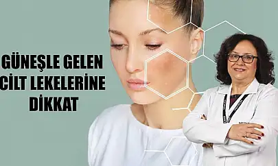 Güneşle gelen cilt lekelerine dikkat