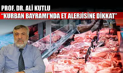 Prof. Dr. Ali Kutlu: 'Kurban Bayramı'nda et alerjisine dikkat'