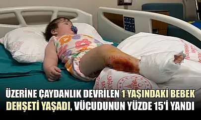 Üzerine çaydanlık devrilen 1 yaşındaki bebek dehşeti yaşadı, vücudunun yüzde 15'i yandı