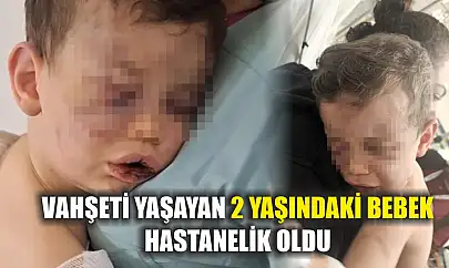 Vahşeti yaşayan 2 yaşındaki bebek hastanelik oldu