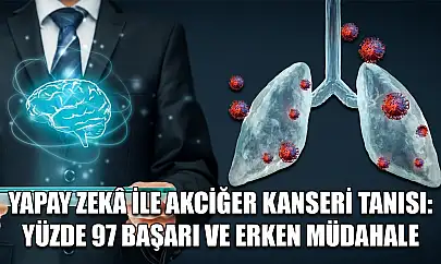 Yapay zekâ ile akciğer kanseri tanısı: Yüzde 97 başarı ve erken müdahale