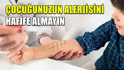 Çocuğunuzun alerjisini hafife almayın