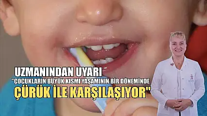 Uzmanından uyarı: 'Çocukların büyük kısmı yaşamının bir döneminde çürük ile karşılaşıyor'