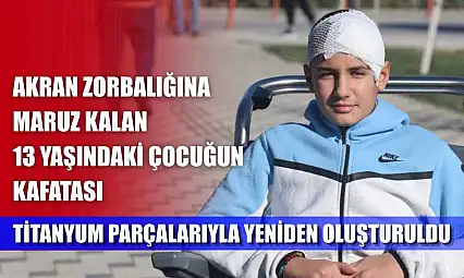 Akran zorbalığına maruz kalan 13 yaşındaki çocuğun kafatası titanyum parçalarıyla yeniden oluşturuldu
