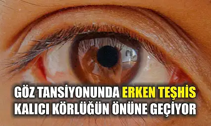 Göz tansiyonunda erken teşhis kalıcı körlüğün önüne geçiyor
