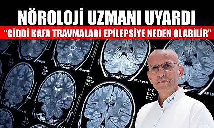 Nöroloji uzmanı uyardı: 'Ciddi kafa travmaları epilepsiye neden olabilir'