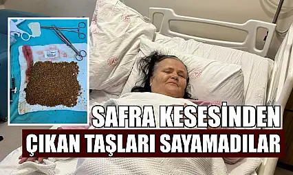 Safra kesesinden çıkan taşları sayamadılar
