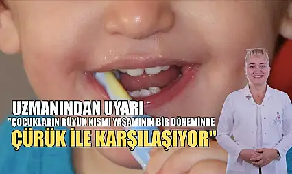 Uzmanından uyarı: 'Çocukların büyük kısmı yaşamının bir döneminde çürük ile karşılaşıyor'