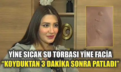 Yine sıcak su torbası yine facia: 'Koyduktan 3 dakika sonra patladı'