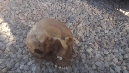 Köpeğin getirdiği insan kafatası polisi alarma geçirdi