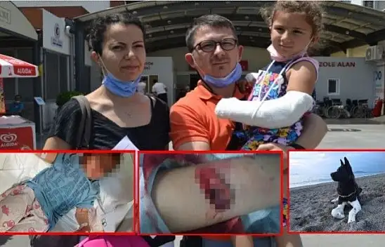 3 yaşındaki çocuğun kolunu köpek parçaladı