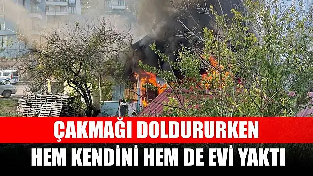 Çakmağı doldururken hem kendini hem de evi yaktı
