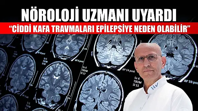 Nöroloji uzmanı uyardı: 'Ciddi kafa travmaları epilepsiye neden olabilir'