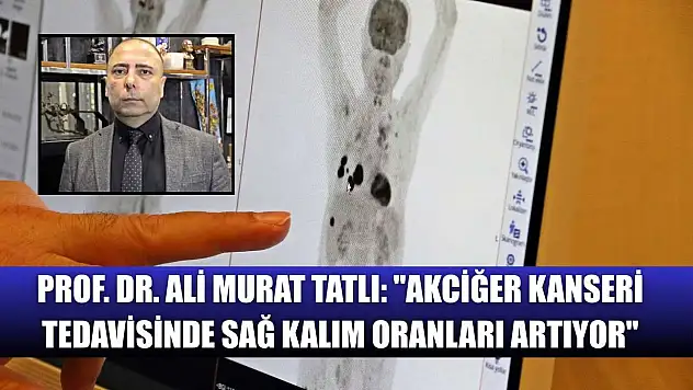 Prof. Dr. Ali Murat Tatlı: 'Akciğer kanseri tedavisinde sağ kalım oranları artıyor'