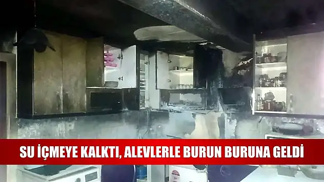 Su içmeye kalktı, alevlerle burun buruna geldi