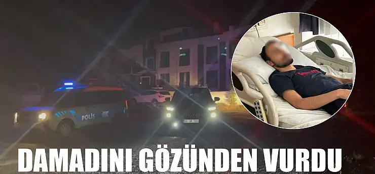 Damadını gözünden vurdu