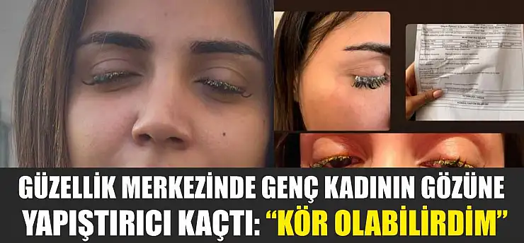 Güzellik merkezinde genç kadının gözüne yapıştırıcı kaçtı: 'Kör olabilirdim'