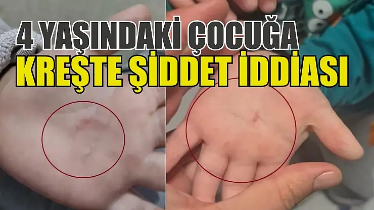4 yaşındaki çocuğa kreşte şiddet iddiası