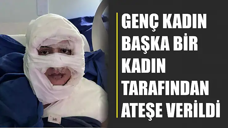 Akıl almaz olay: Genç kadın başka bir kadın tarafından ateşe verildi