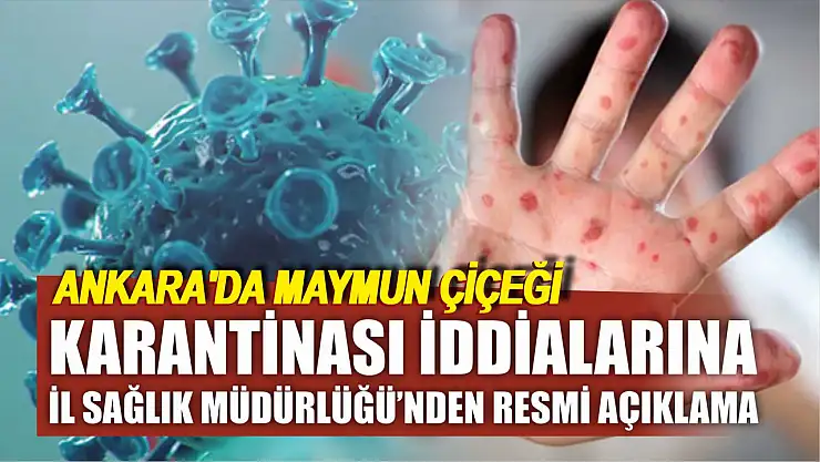 Ankara'da Maymun Çiçeği Karantinası İddialarına Resmi Açıkama
