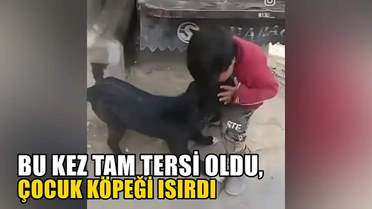 Bu kez tam tersi oldu, çocuk köpeği ısırdı