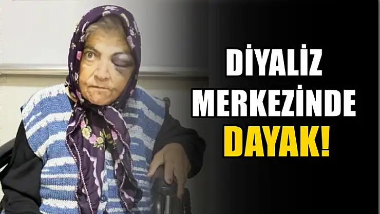 Diyaliz merkezinde dayak!