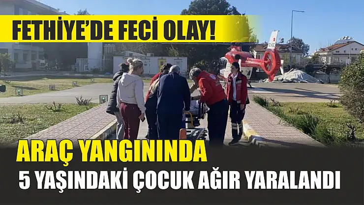 Fethiye'de feci olay! Araç yangınında 5 yaşındaki çocuk ağır yaralandı