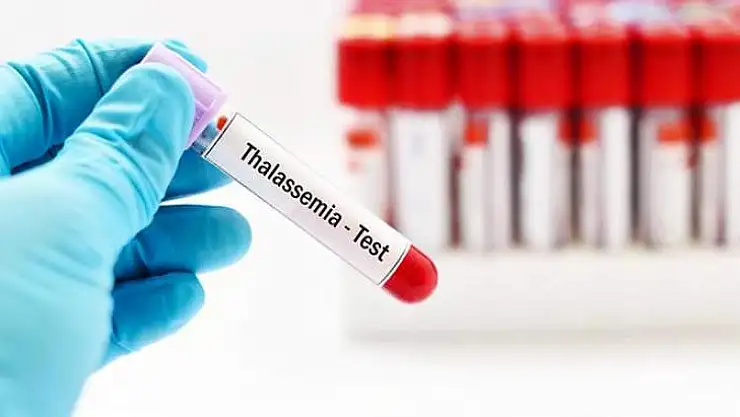 'AKDENİZ ANEMİSİ'NE DİKKAT!