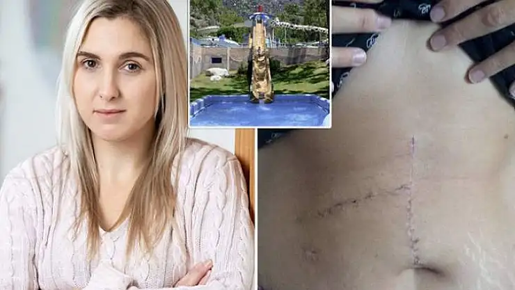 FETHİYE'DE OBEZ KADIN ÜSTÜME DÜŞTÜ KABURGALARIM KIRILDI