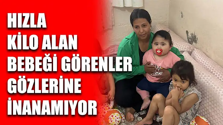 Hızla Kilo Alan Bebeği Görenler Gözlerine İnanamıyor