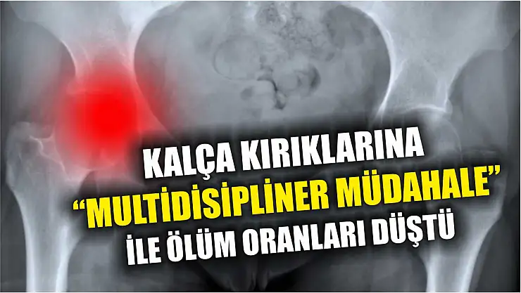 Kalça kırıklarına 'multidisipliner müdahale' ile ölüm oranları düştü