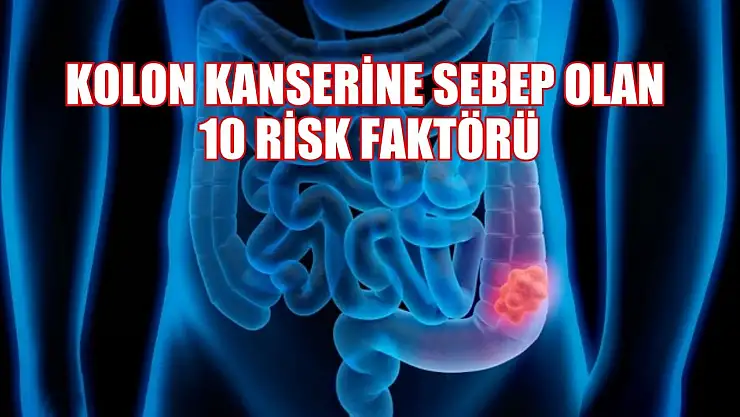 Kolon kanserine sebep olan 10 risk faktörü