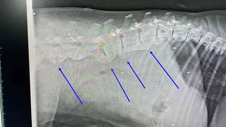 Vücudunda onlarca saçma ile yaşadığı ortaya çıktı