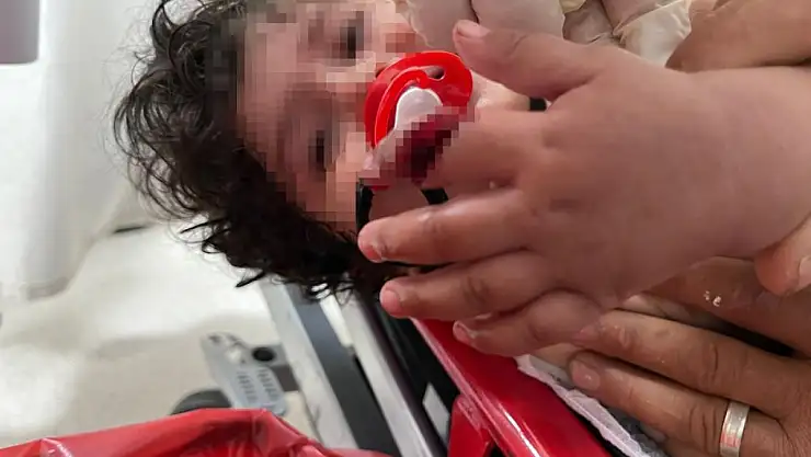 Parmağını vantilatöre kaptıran 1 yaşındaki bebek dehşeti yaşadı