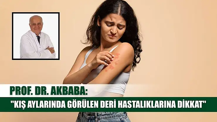 Prof. Dr. Akbaba: 'Kış aylarında görülen deri hastalıklarına dikkat'