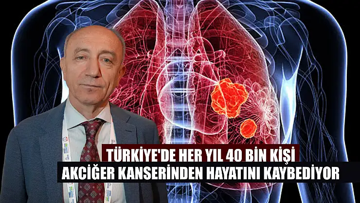 Türkiye'de her yıl 40 bin kişi akciğer kanserinden hayatını kaybediyor
