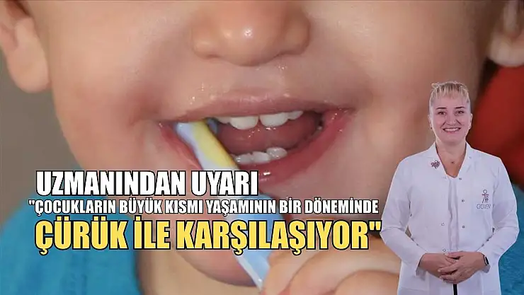 Uzmanından uyarı: 'Çocukların büyük kısmı yaşamının bir döneminde çürük ile karşılaşıyor'