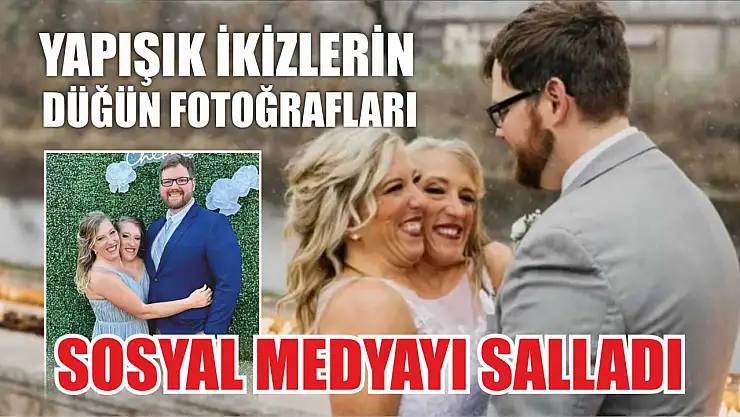 Yapışık ikizlerin düğün fotoğrafları sosyal medyayı salladı