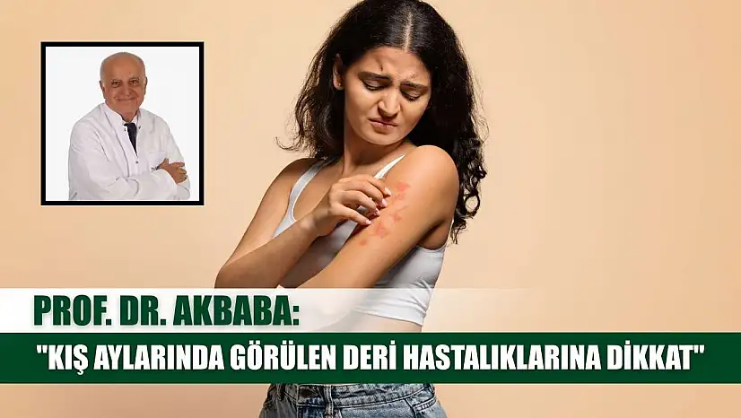 Prof. Dr. Akbaba: 'Kış aylarında görülen deri hastalıklarına dikkat'