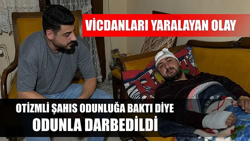 Vicdanları yaralayan olay: Otizmli şahıs odunluğa baktı diye odunla darbedildi