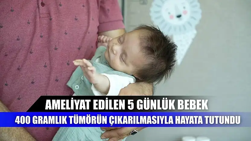 Ameliyat edilen 5 günlük bebek, 400 gramlık tümörün çıkarılmasıyla hayata tutundu