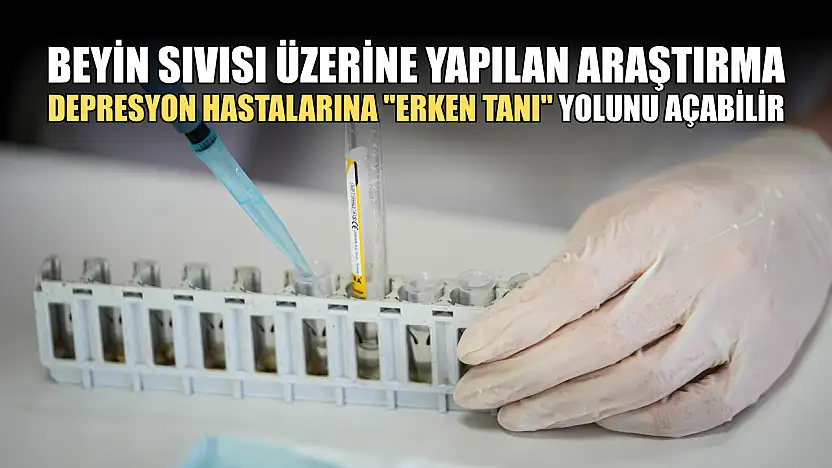 Beyin sıvısı üzerine yapılan araştırma depresyon hastalarına 'erken tanı' yolunu açabilir
